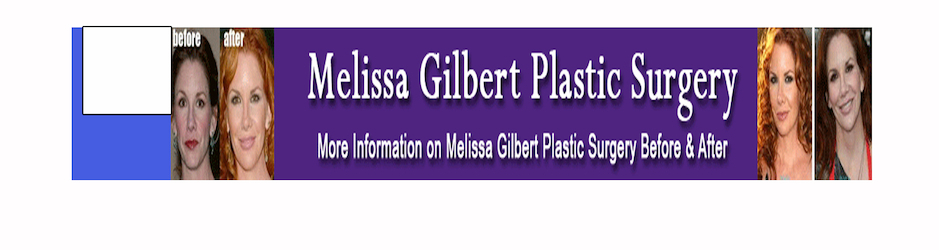 Melissa Gilbert Plastic Surgery