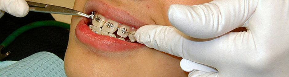 Dentalimplants070