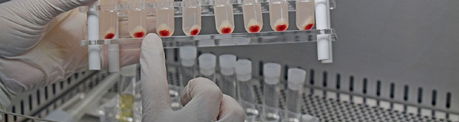 Células madre tratamiento