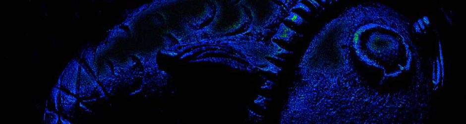 100 million steps to heaven