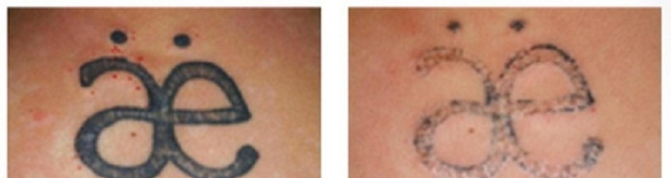 How much does a tattoo cost