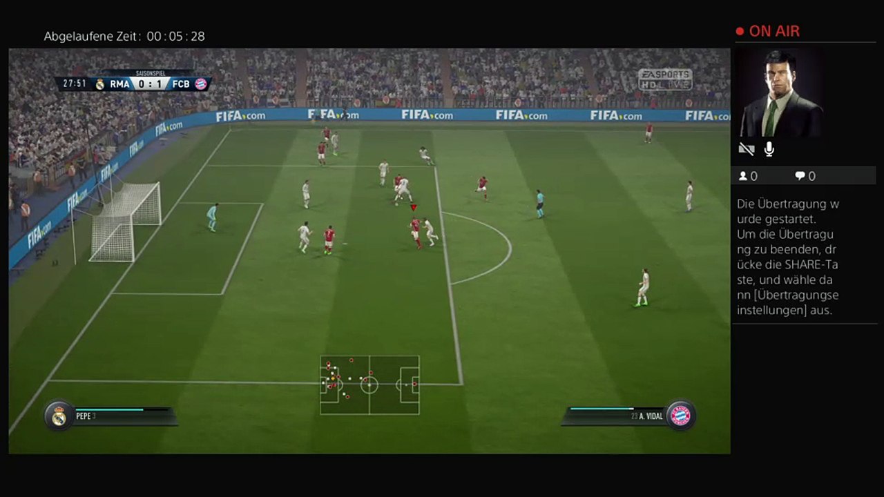Ps4-live-Übertragung von exoicehd