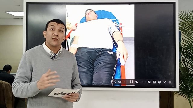 طبيب يكشف أعراض مرض الكرونز المصاب به حمو بيكا.. وحقيقة حقنة الـ 130 ألف جنيه كل أسبوع