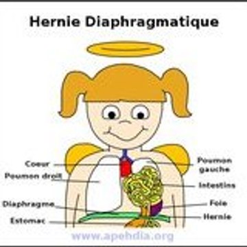 Association Apehdia