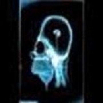 Moussarazer Moussachi