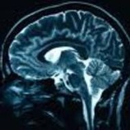 correction-cerebrale