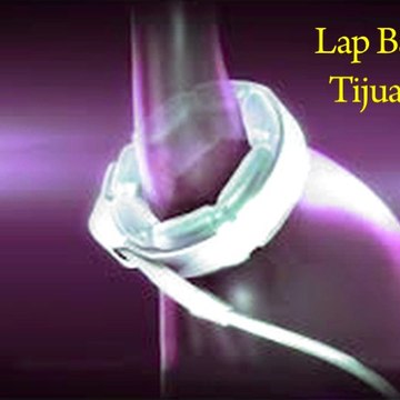 Lapband Tijuana