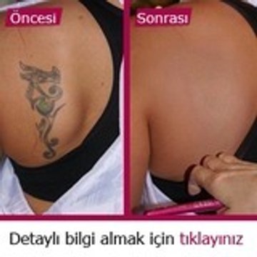 lazerledovmesilme