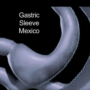 Gastric Sleeve mexico