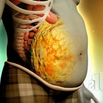 losesubcutaneousbellyfat