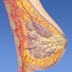 Breast Augmentation Cost