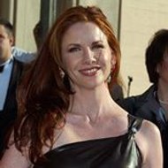 Melissa Gilbert Plastic Surgery