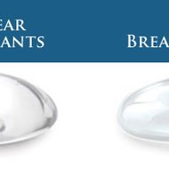 Gummy Bear Implants Cost