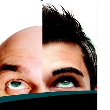 Elithairtransplant Haartransplantation