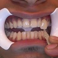 infodentist