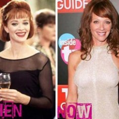 Celebrity Plastic Surgery