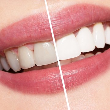 Calgary Denture Clinic