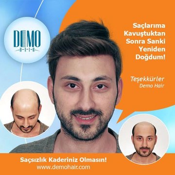 Demohair Türkiye istanbul