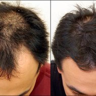 integratori per capelli