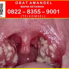 Obat Amandel