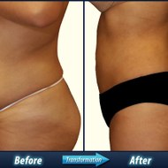 how to burn fat cells