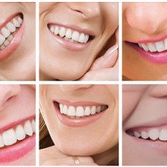 UltraSmileExpress