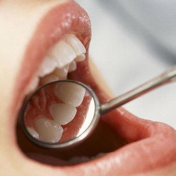 Dental Hygiene