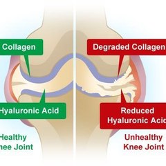 collagen supplements