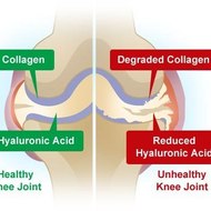 collagen supplements