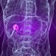 Gallbladder Cancer