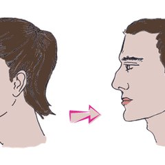 Transgendersurgery