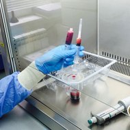 Células madre tratamiento