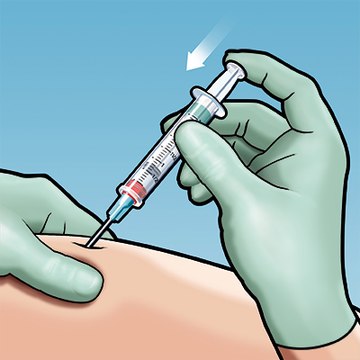 Administer