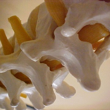 Quiropráctica Bilbao Quiropráctico Algorta