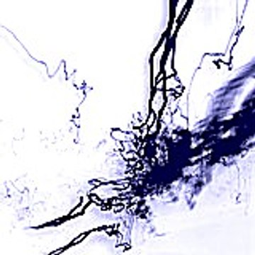 Gilacu