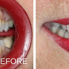 Brookhaven Cosmetic Dentist