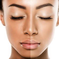 SKIN LIGHTENING CREAM PILLS INJECTION +27731769304