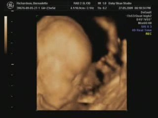 baby scan 4D southwest