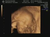 4D Baby Scan
