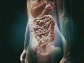 Trailer - Dementium II