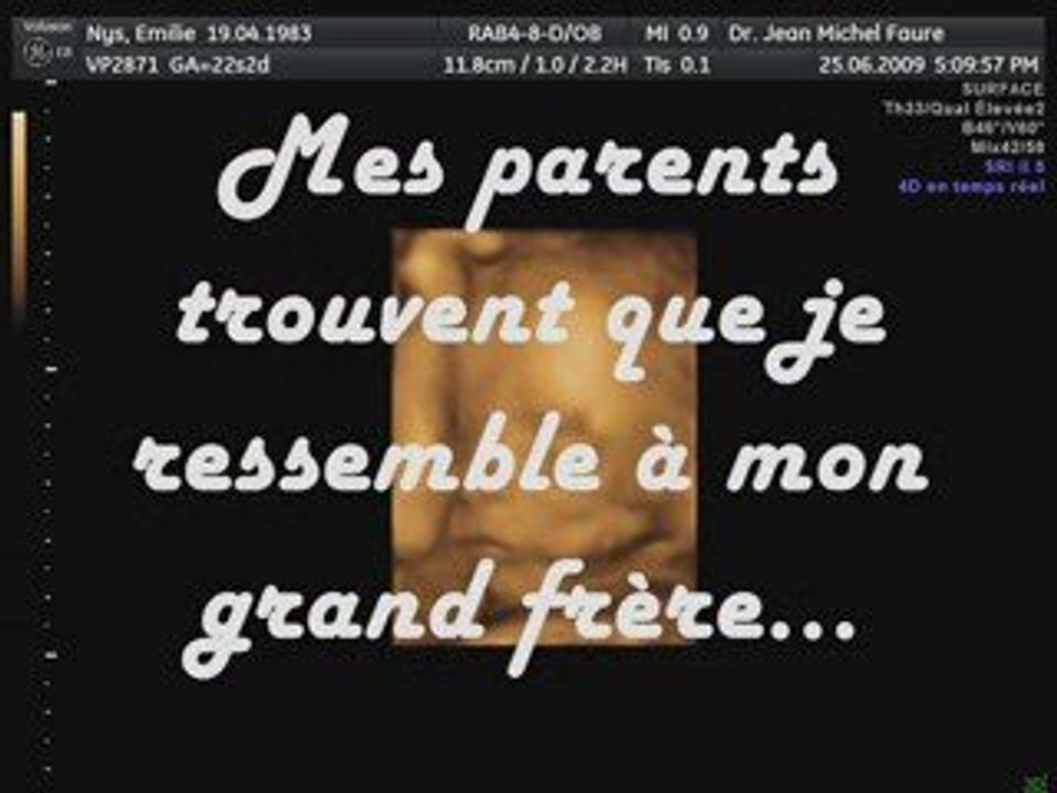 Sans Titre