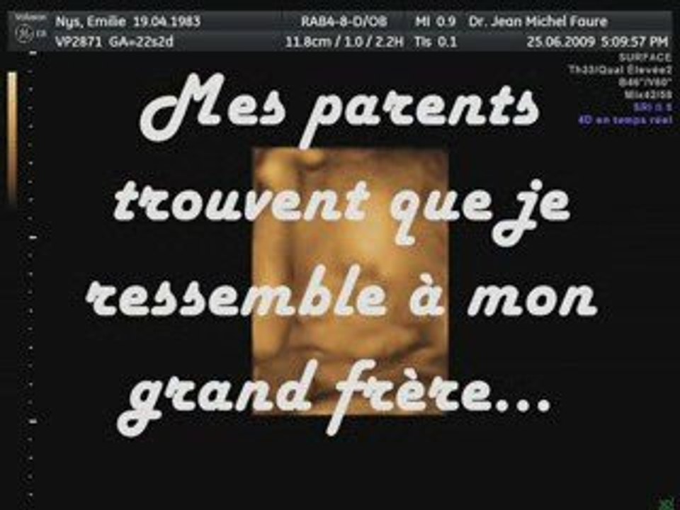 Sans Titre
