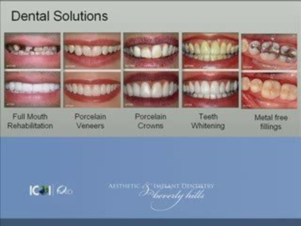 Unforgettable Smile - Aesthetic and Implant Dentistry ...