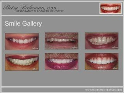 Micosmetic Dentist - Restorative & Cosmetic Dentistry, ...