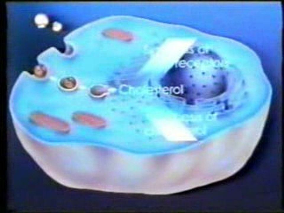 Arteroesclerosis