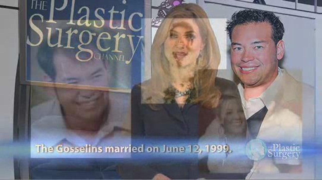 Jon And Kate Plus Plastic Surgery