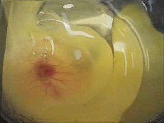 Mucizeye buna denir & it is a miracle