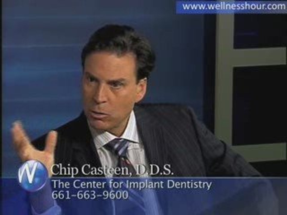 Dr. Chip Casteen - Dental Implants
