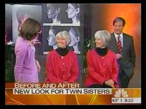 Dr. Antell explains aging in twins on the Today show.