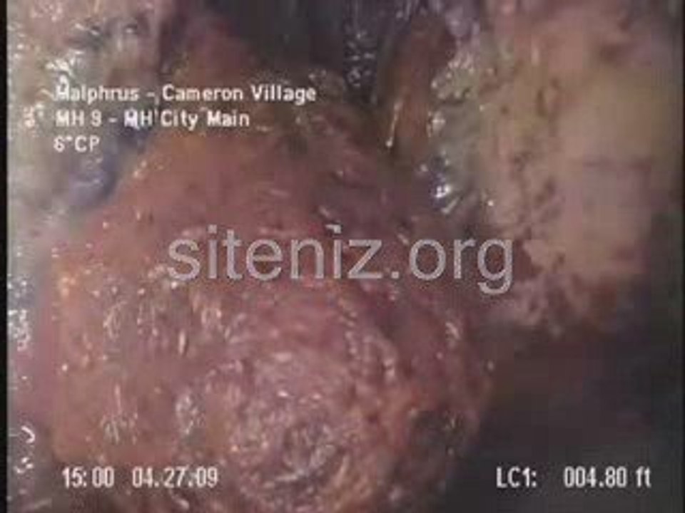 Malphrus Cameron Village Sewer Blob